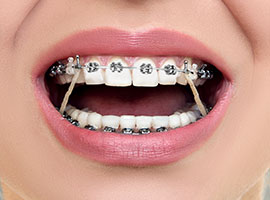 Elastics example Elastics example